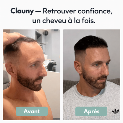 Sérum de Repousse Capillaire